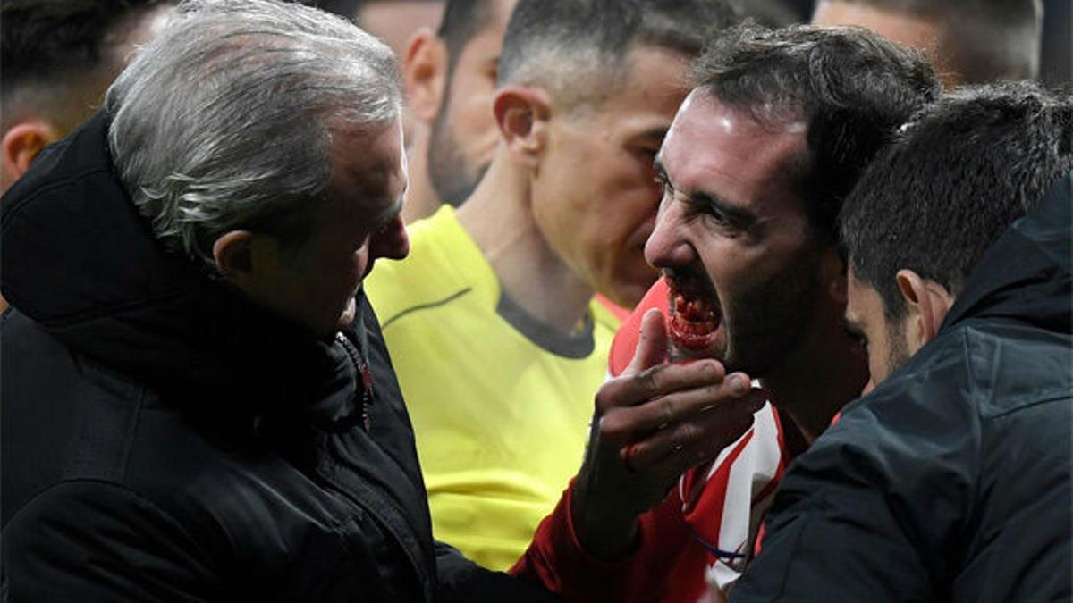 LALIGA | Atlético-Valencia (1-0) | Godín se rompió varios dientes en una acción con Neto