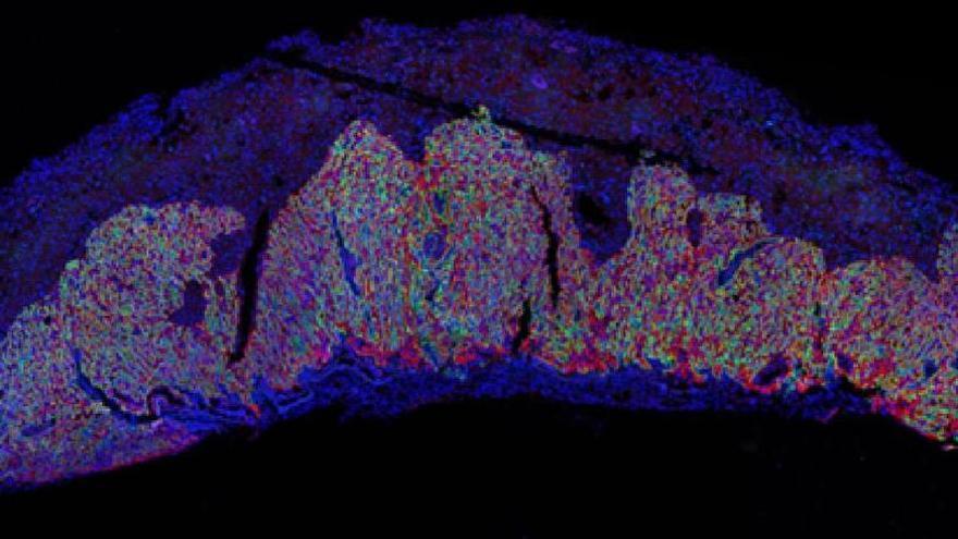 Uno studio rivela il ruolo chiave di una proteina nella formazione della placenta e la crescita del feto