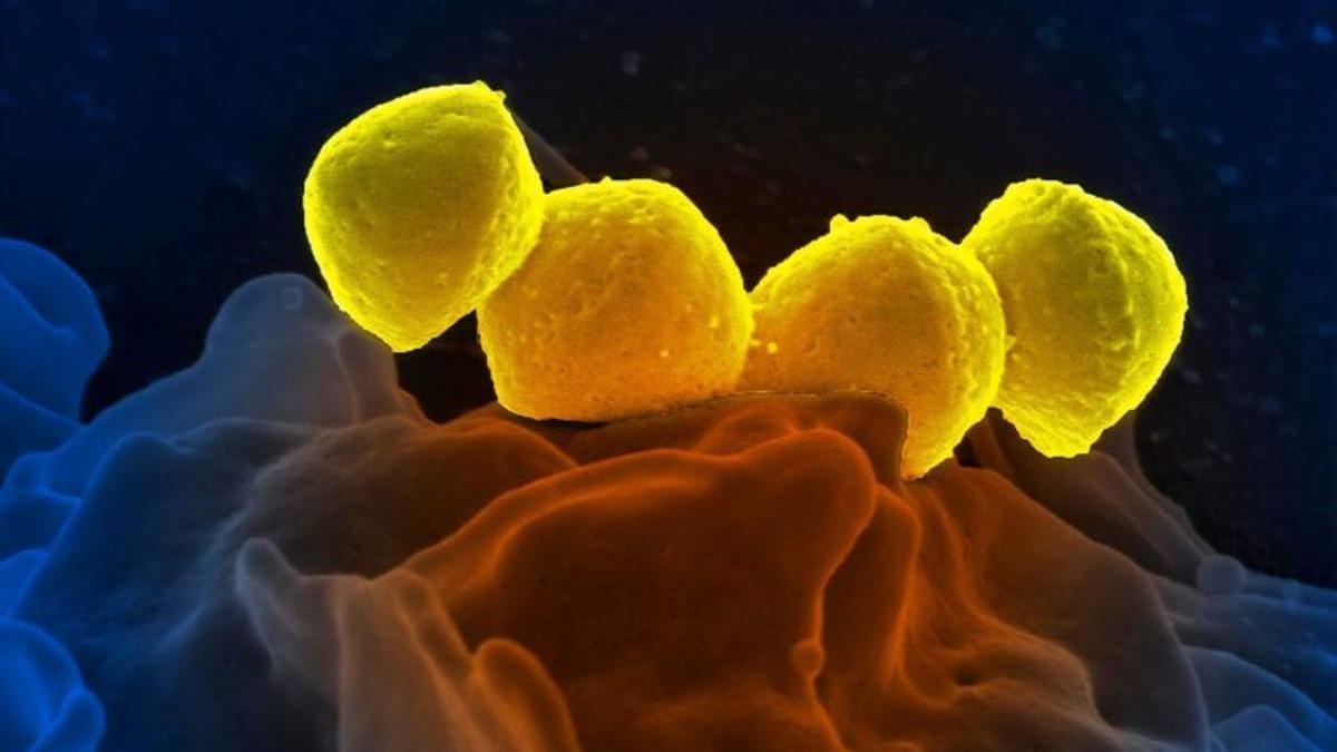 Las células humanas crean su propio «detergente» contra las infecciones