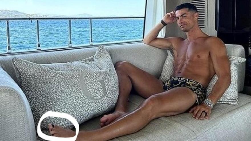 Cristiano Ronaldo y sus uñas.