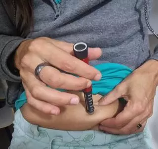 Hito mundial: revierten la diabetes de una mujer con un trasplante de células madre de su organismo