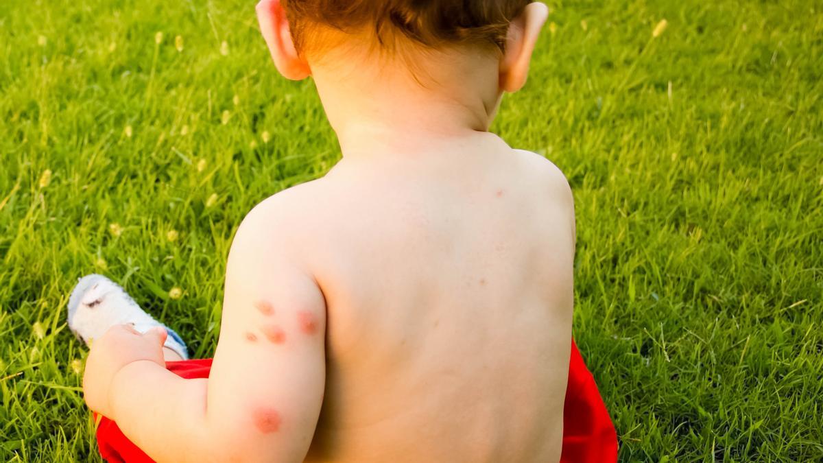 Así debes proteger a los bebés de las picaduras de mosquito.