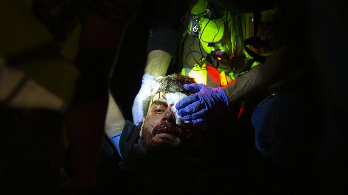 Un joven pierde un ojo por las cargas policiales en el aeropuerto de Barcelona.