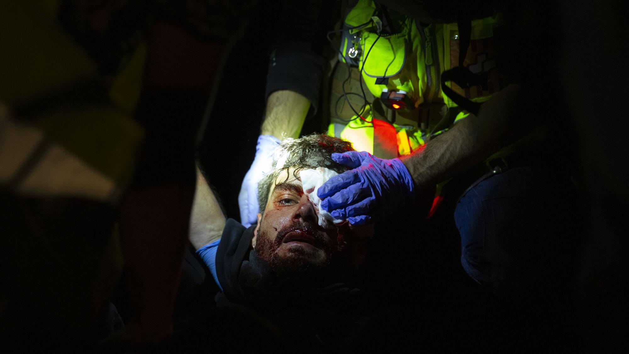 El joven pierde un ojo por las cargas policiales en el aeropuerto de Barcelona.