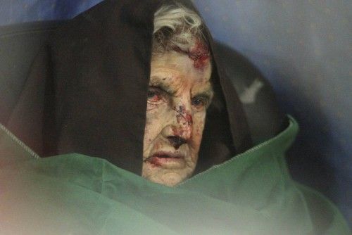 An injured woman rests at a field hospital in Douma