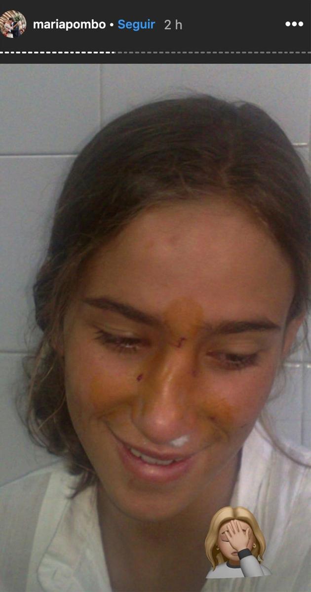 María Pombo y su operación de nariz