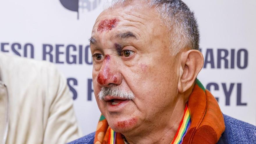 Pepe Álvarez, secretario general de UGT, herido en la cara tras caerse practicando ciclismo
