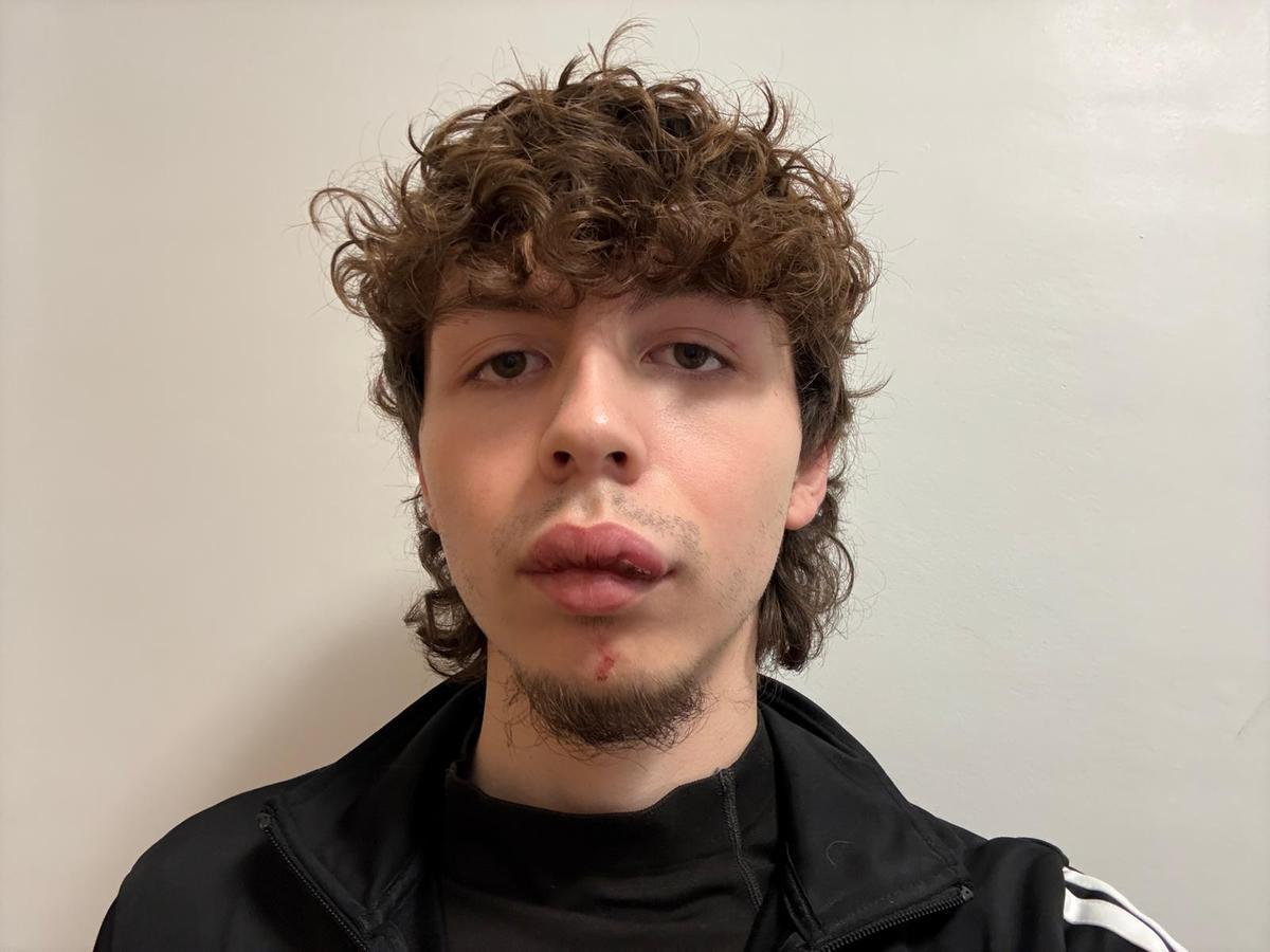 Samuel, el joven que ha sido atropellado en una rotonda de Badajoz.