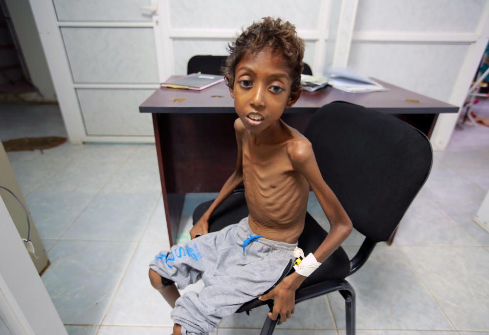 Imran Faraj, 8 year-old, who is suffering from ...