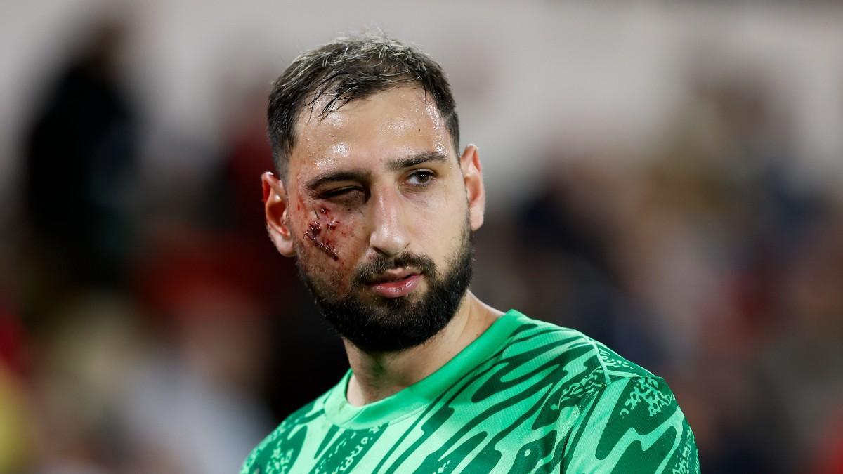 Donnarumma, tras la brutal patada que recibió en la cara ante el Mónaco