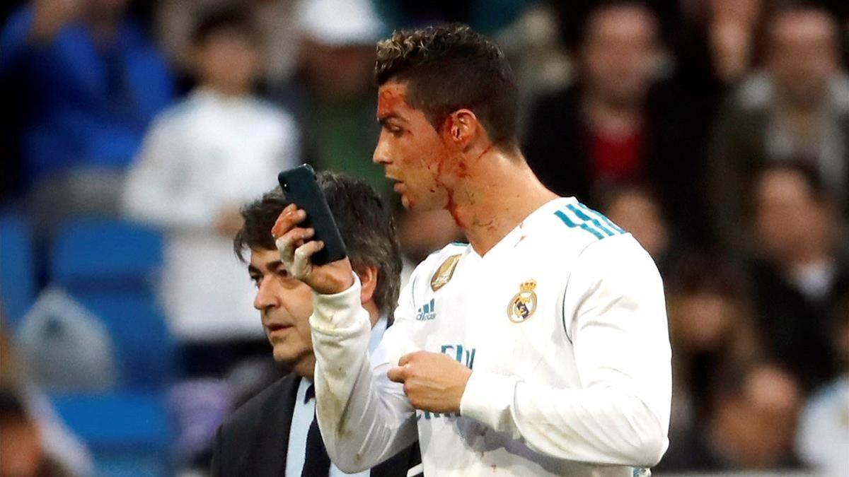 Cristiano abandona el césped del Bernabéu mirándose la brecha en la ceja en el móvil del médico.