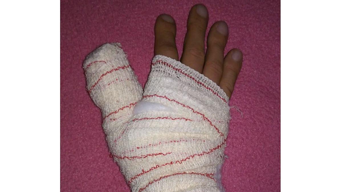 Una lesión en la mano sufrida por el niño chino agredido en Zamora.