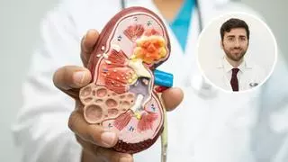 Borja Quiroga, especialista en nefrología: "La creatina no destruye el riñón; eso es falso y muy falso"