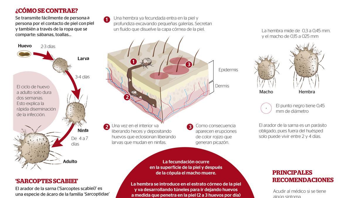 La sarna se transmite fácilmente a través del contacto de la piel entre personas