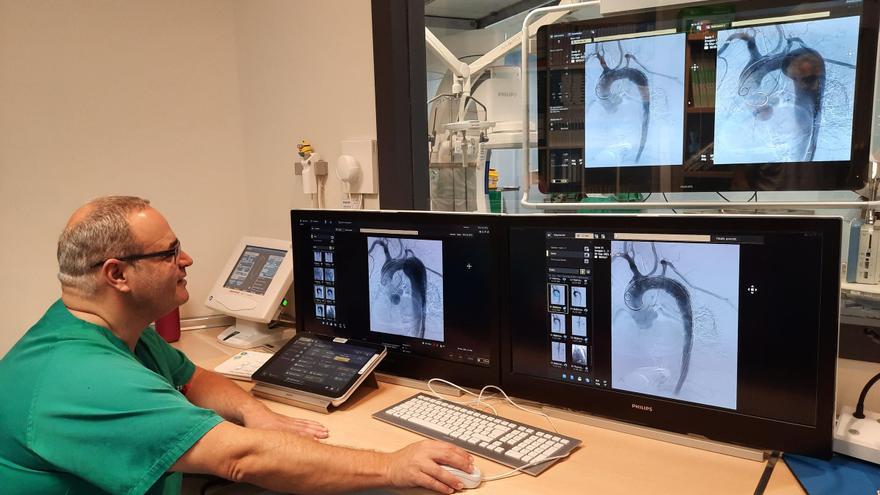 Pacientes a casa a las 48 horas de desgarrarse la pared de la aorta gracias a una prótesis