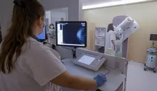 El cribado de cáncer de pulmón llegará a Aragón el próximo año