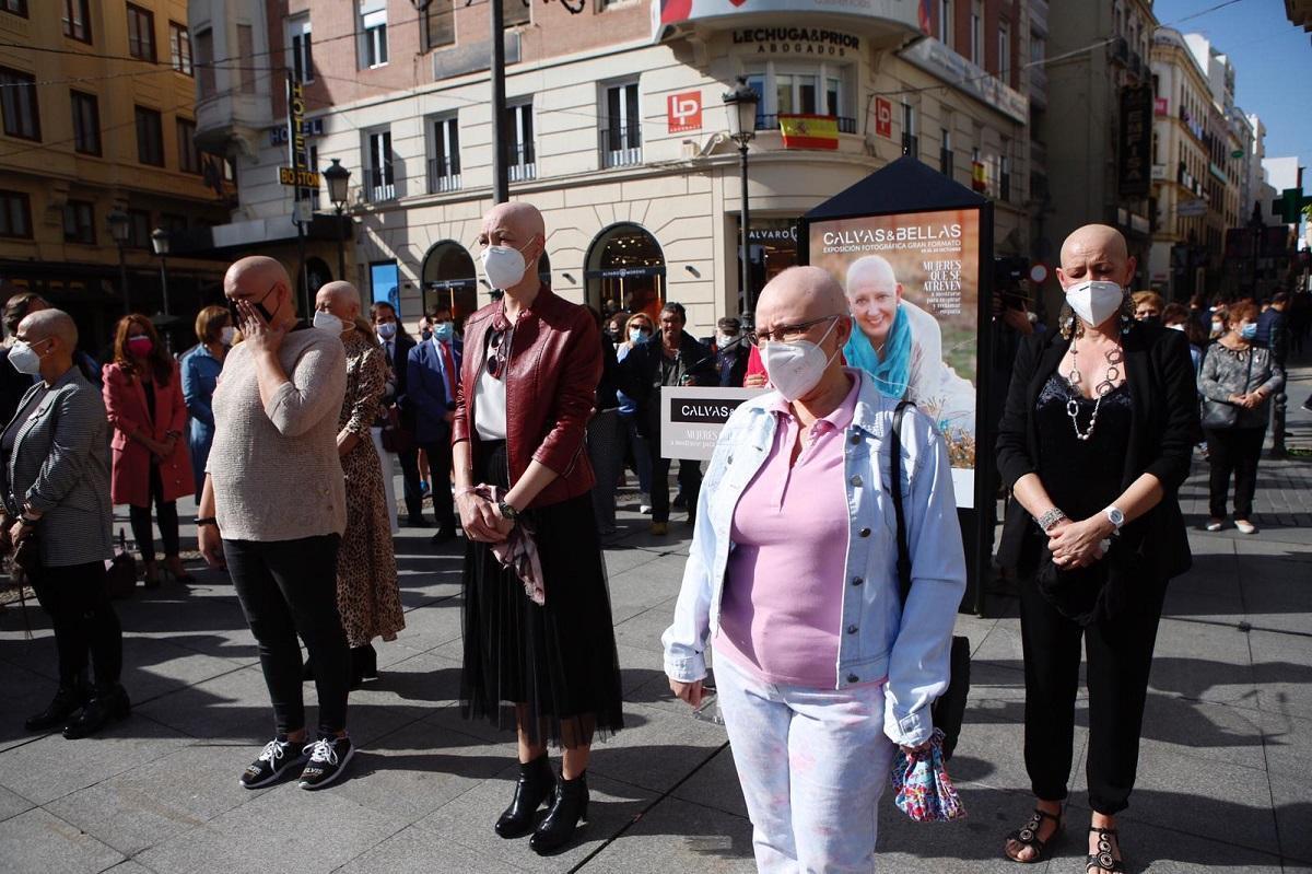 'Calvas y bellas', una invitación a mirar al cáncer a los ojos