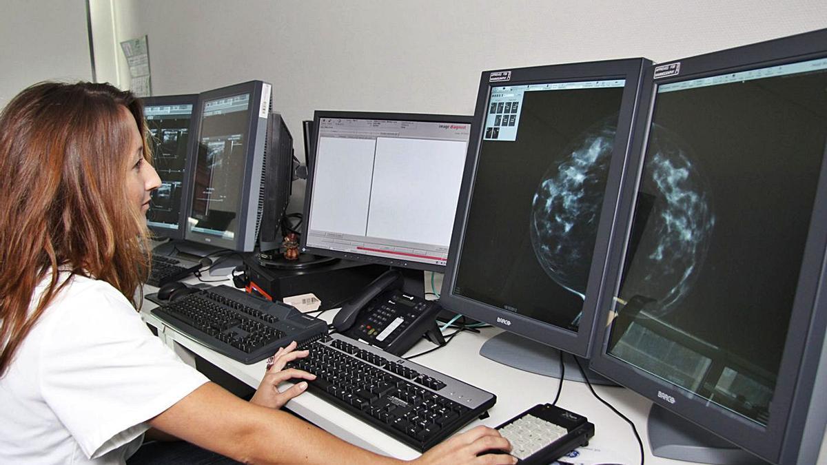 Una radióloga examinando una mamografía realizada en el hospital de Son Espases. | DIARIO DE MALLORCA