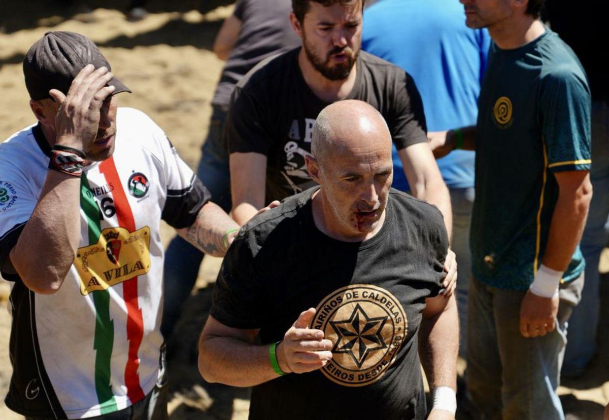 Bazal, tras recibir un golpe en el labio. |