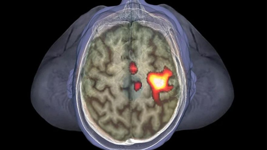 El cerebro activa células inmunes cuando hay personas enfermas cerca