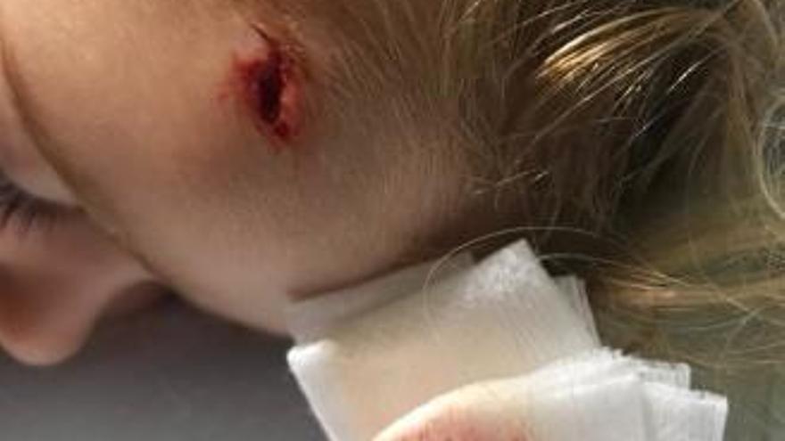 La niña presentaba una herida de un centímetro en la frente.