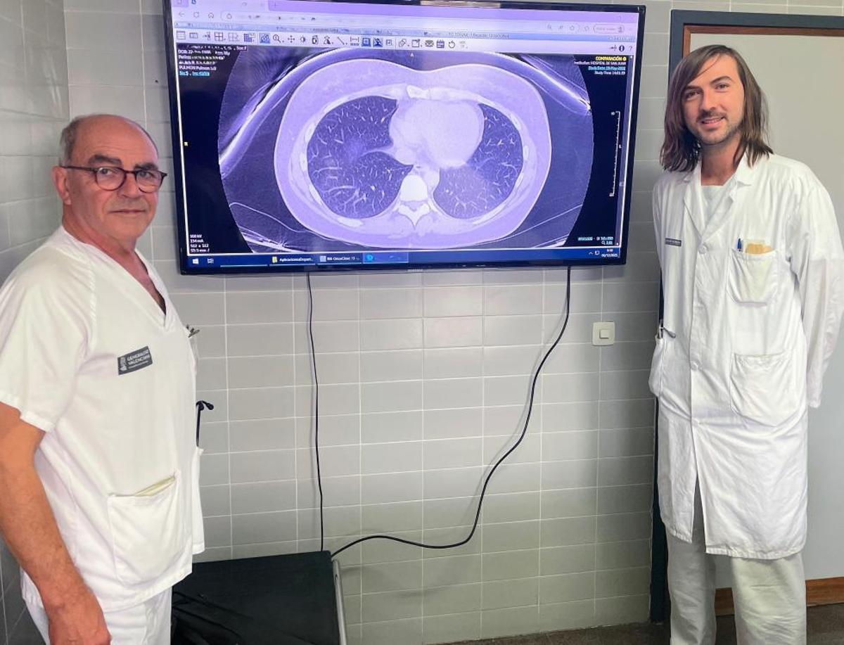 Eusebi Chiner e Ignacio Boira, neumólogos Hospital Universitario Sant Joan d'Alacant con un TAC de tórax