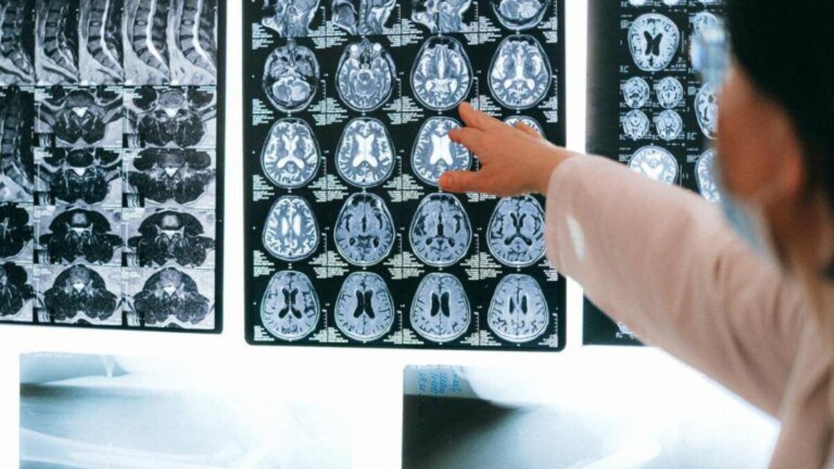 Consejos del neurólogo para mantener un cerebro sano