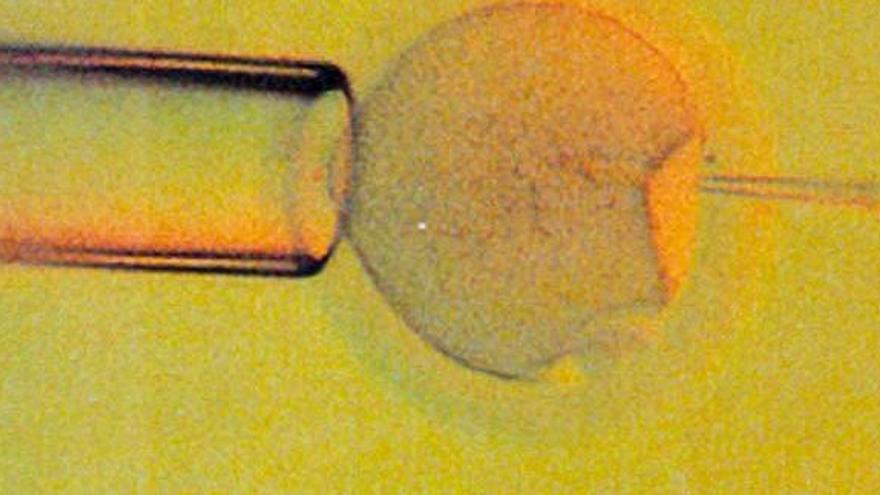 Disminuye la calidad de los espermatozoides de los asturianos