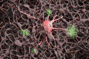 Un nou biomarcador sanguini permet anticipar si es desenvoluparà Alzheimer