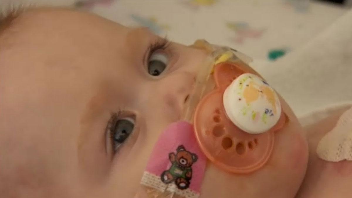 La increíble historia de Vanellope, la niña que nació con el corazón fuera del cuerpo.