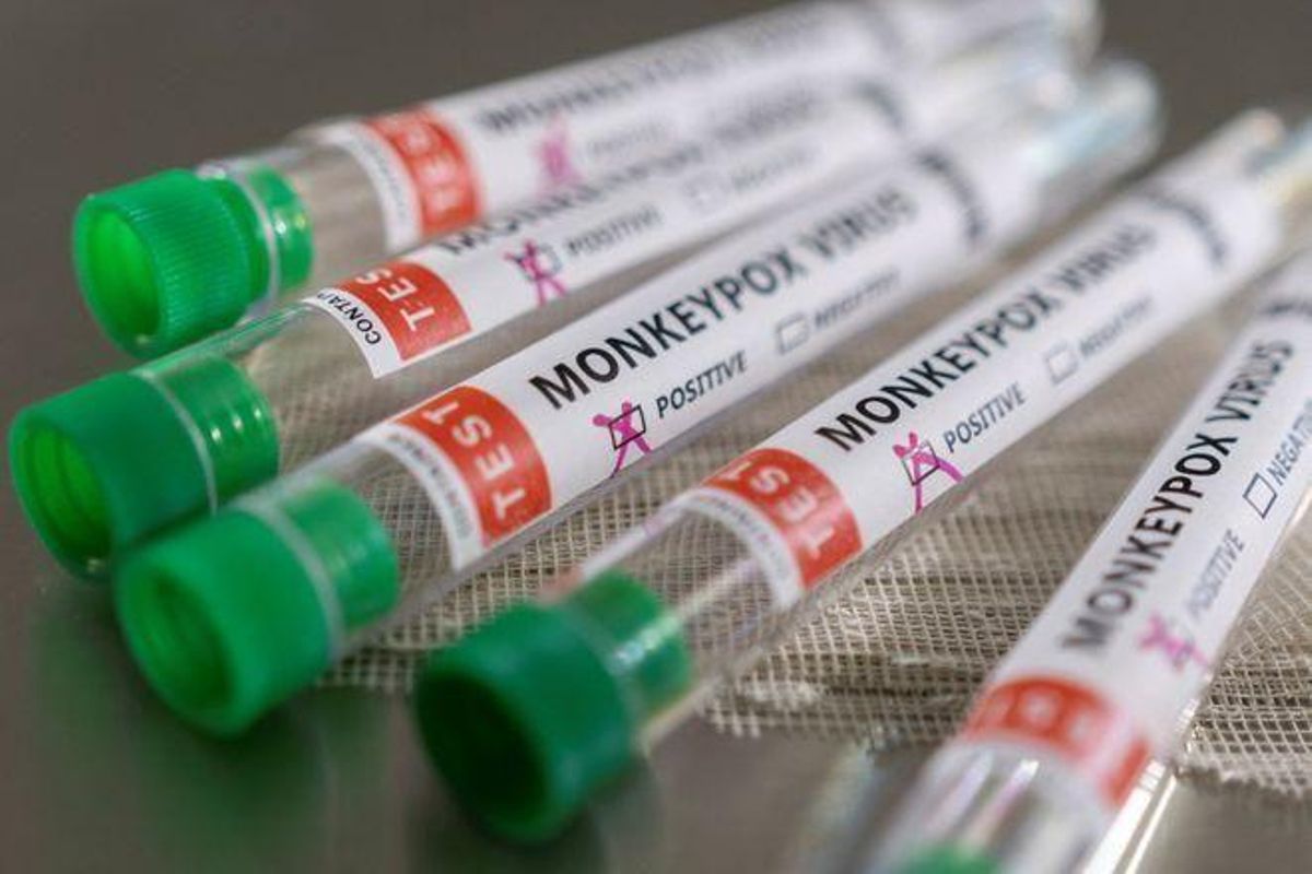 Detectats quatre casos de la verola del mico a Catalunya Detectats quatre casos de la verola del mico a Catalunya