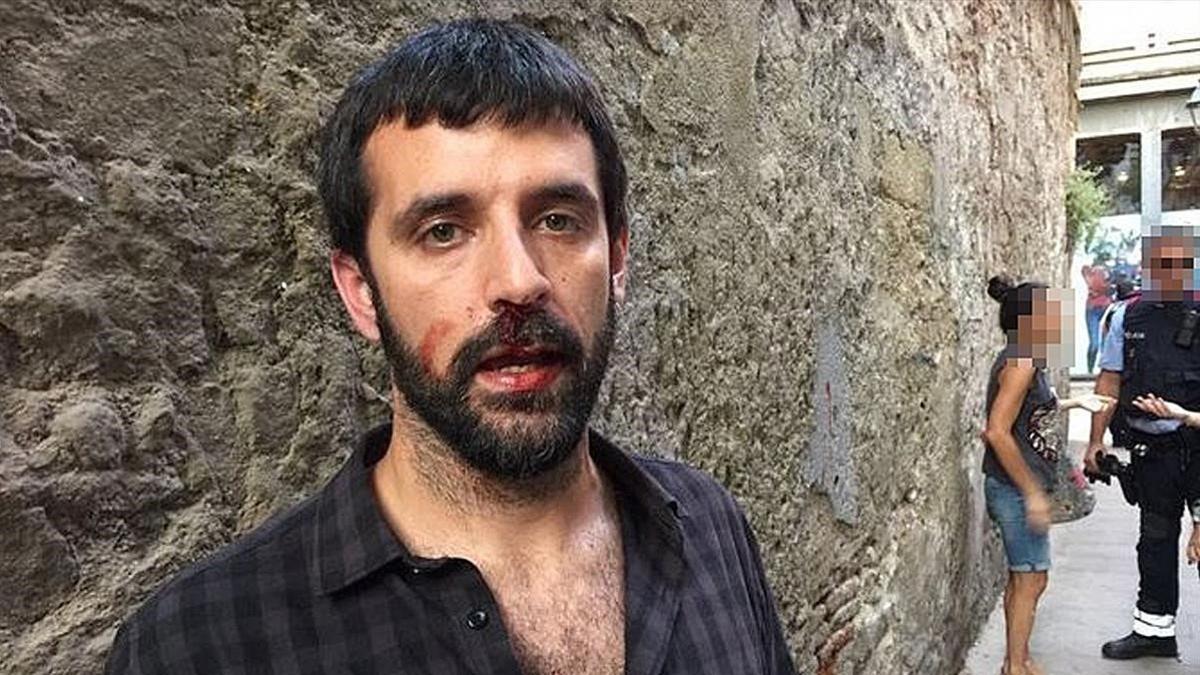 El fotoperiodista Jordi Borràs, tras ser agredido el pasado 16 de julio.