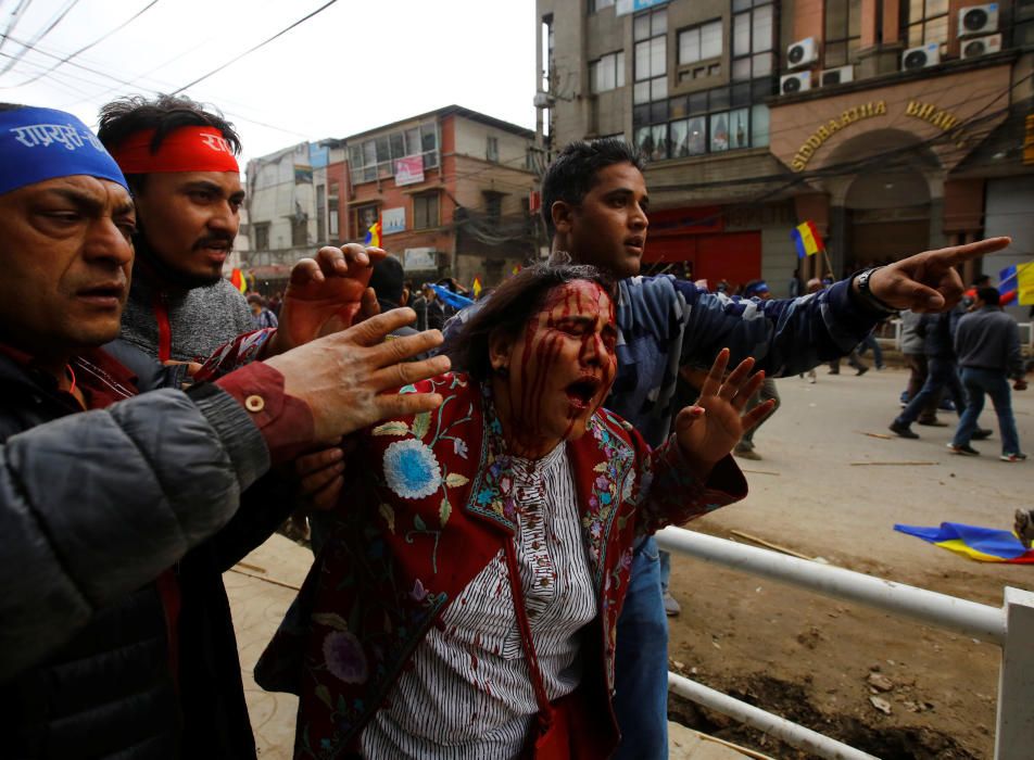 Una activista hindú herida en unos disturbios por el veto del gobierno nepalí a un partido pro-hindú, en Katmandú.