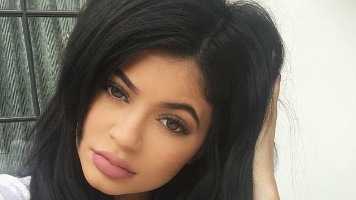 Gracias a Kylie Jenner operarse antes de los 30 es tendencia