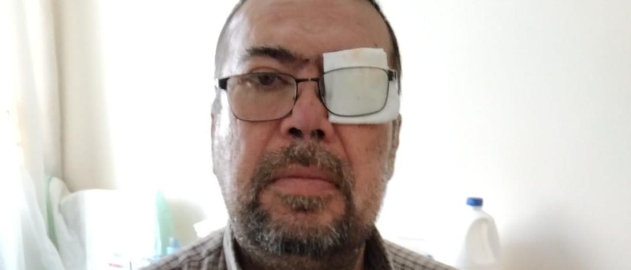Carlos Almenara, vecino de San José de las Longueras, que cayó en un socavón y perdió la visión de un ojo