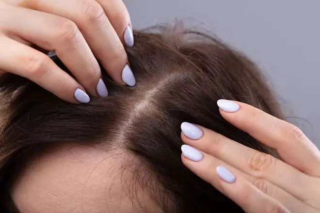'Scalp care': cómo cuidar tu cuero cabelludo para un pelo más sano