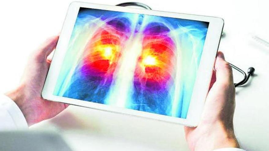 Un médico examina una prueba de imagen de unos pulmones. |   // L.O.