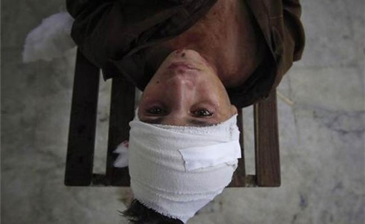 Una llàgrima recorre la cara d’un nen estès en un banc després de ser conduït a l’Hospital Lady Reading de Peshawar (Pakistan).