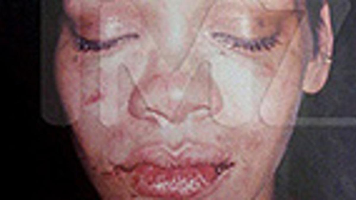 Rihanna, tras ser agredida.