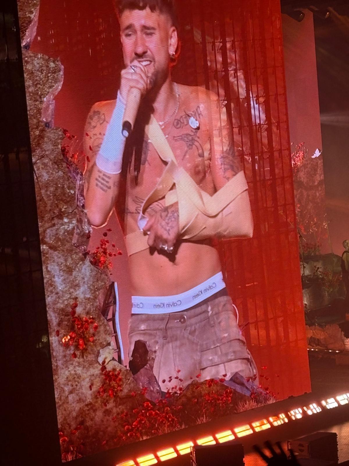 Dani Fernández, con las heridas causadas por su caída en pleno concierto en el Roig Arena