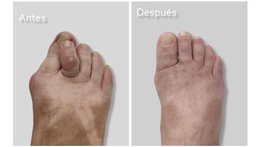 El antes y el después en la Clínica Alejandro Cuervo