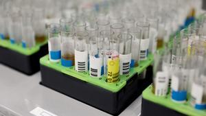 Archivo - Probetas de pruebas PCR en el Laboratorio de Microbiología del Hospital público Gregorio Marañón, a 31 de mayo de 2022, en Madrid (España). El centro hospitalario, junto a otros cuatro en la región, ha comenzado a realizar pruebas PCR para la vi