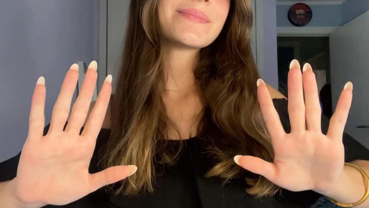 Luana Escoval, de 15 anys, va ser operada a Sant Joan de Déu d’hiperhidrosi.