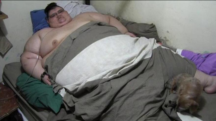 El hombre más obeso del mundo es mexicano y pesa 500 kilos