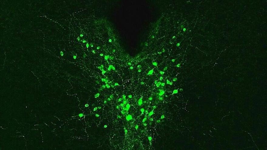 Mujeres y hombres procesan el dolor de forma diferente en el cerebro