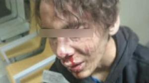 la-delegacin-del-gobierno-en-melilla-abre-expediente-a-cinco-policas-de-paisano-por-una-presunta-paliza-a-un-menor