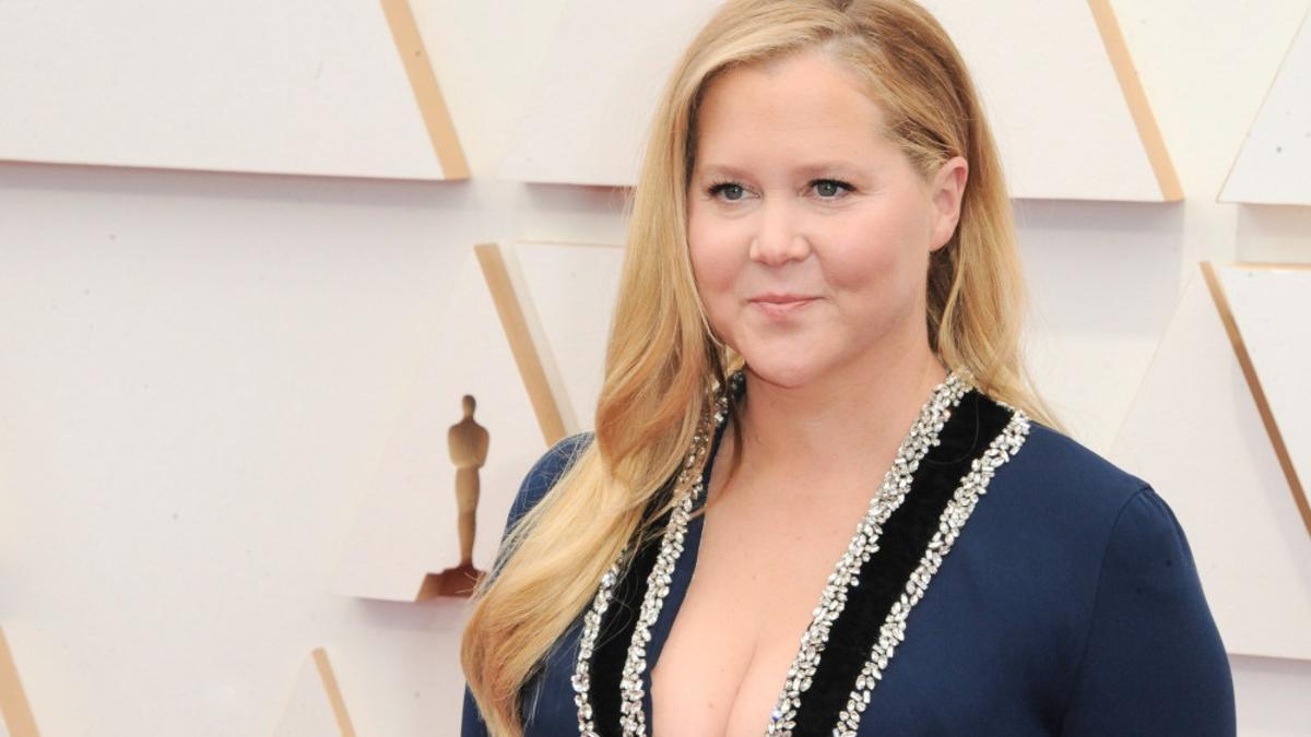 Amy Schumer diagnosticada con síndrome de Cushing