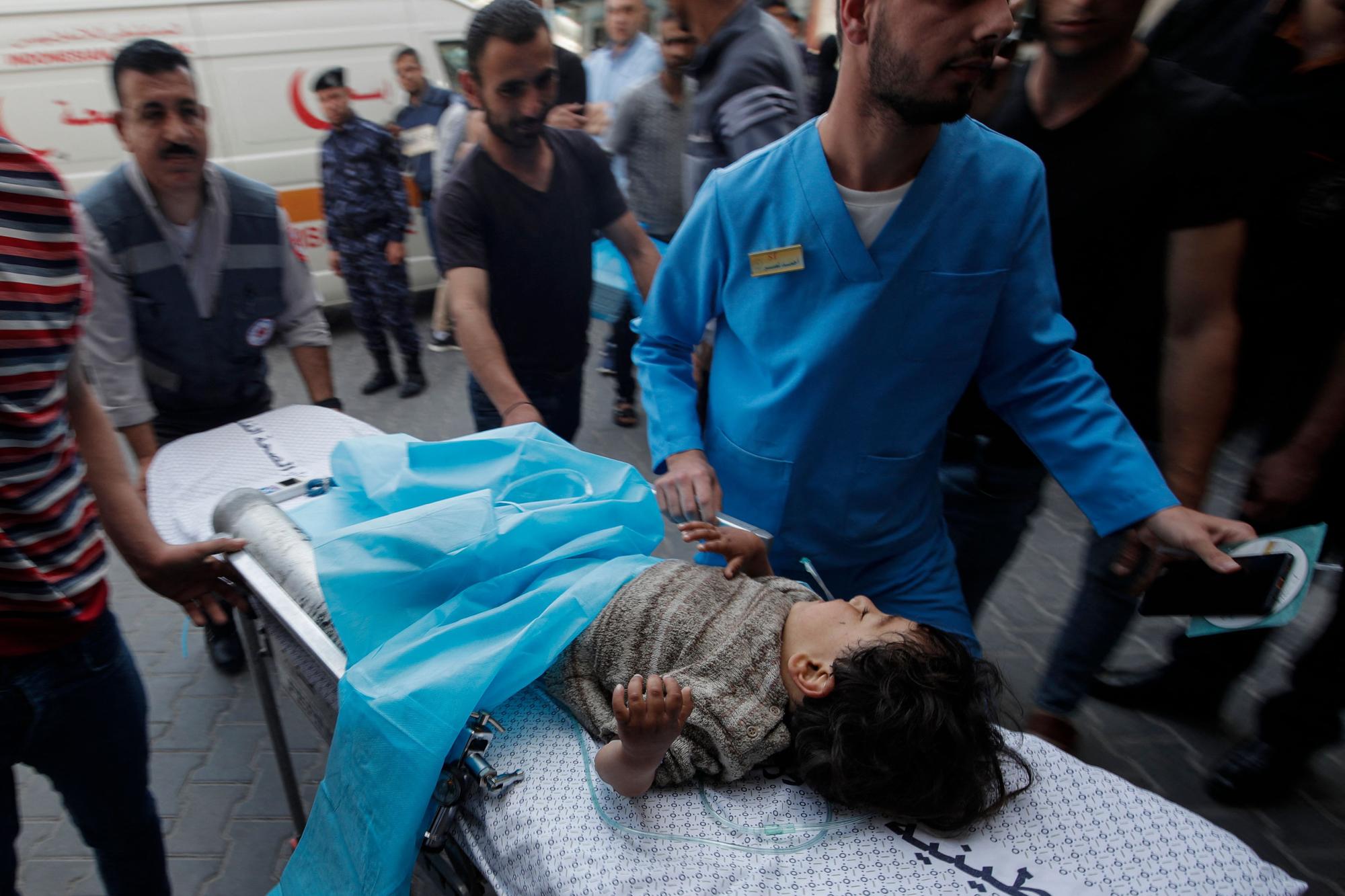 Una niña herida en los bombardeos en Gaza es trasladada al hospital, este miércoles.