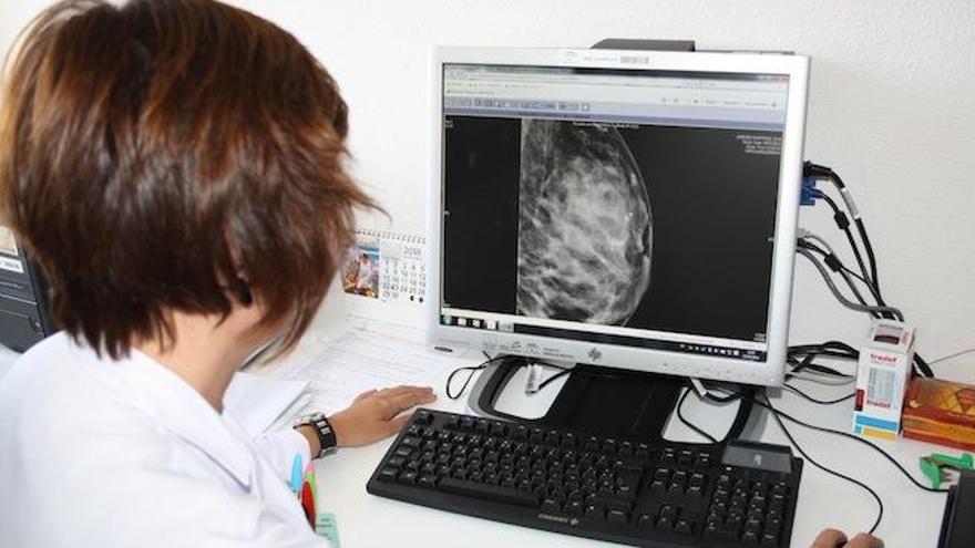 Una doctora revisa los resultados de una mamografía.