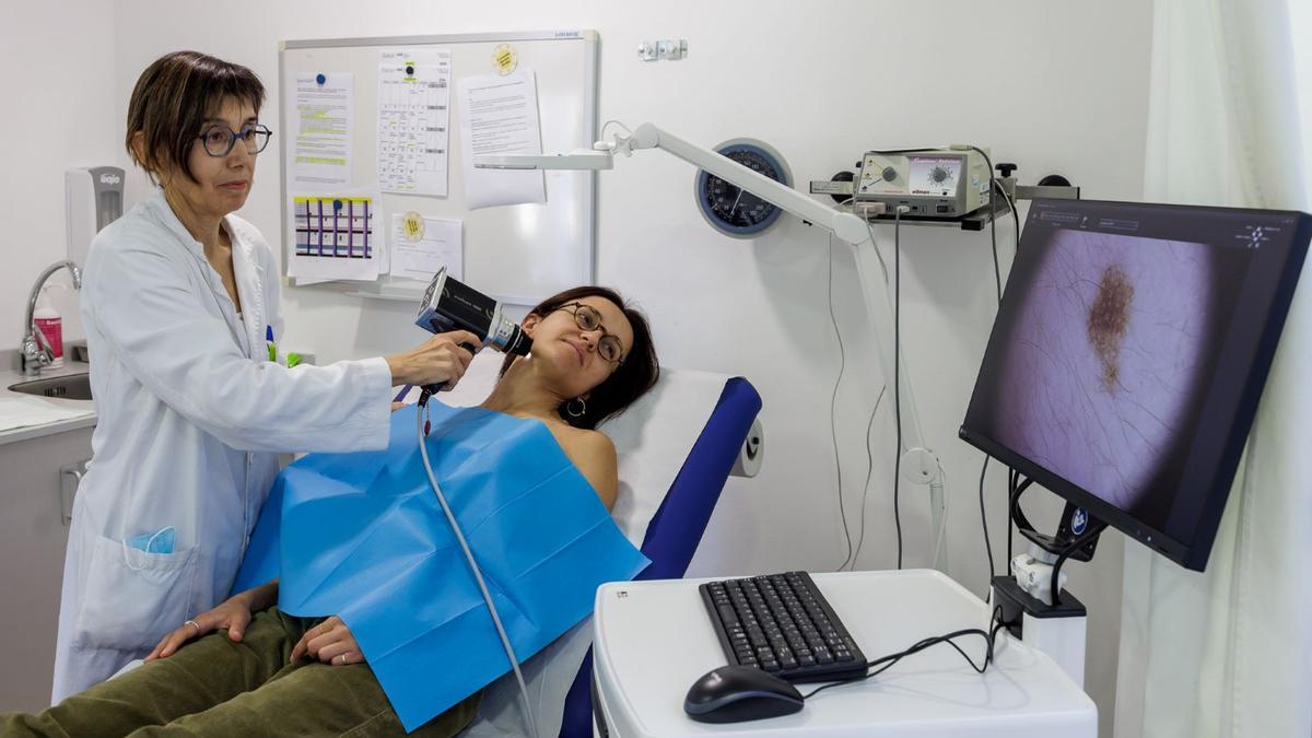 Exploració mitjançant un dermatoscopi digital per part del Servei de Dermatologia del hospitals Trueta i Santa Caterina.
